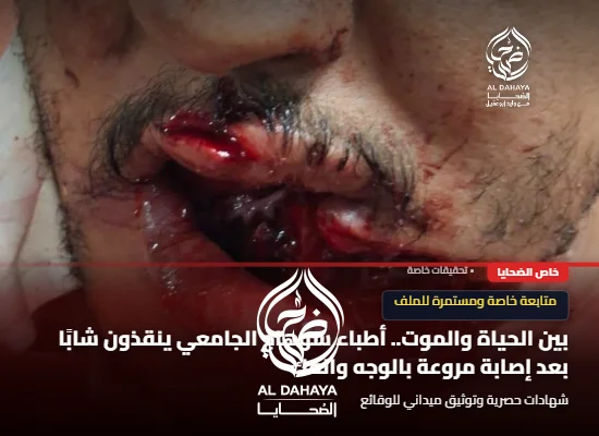 صورة 2 - بين الحياة والموت.. أطباء سوهاج الجامعي ينقذون شابًا بعد إصابة مروعة بالوجه والفك